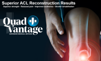 ACL Reconstruction - New Standard